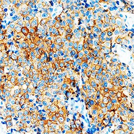 VEGFB Antibody in Immunohistochemistry (Paraffin) (IHC (P))