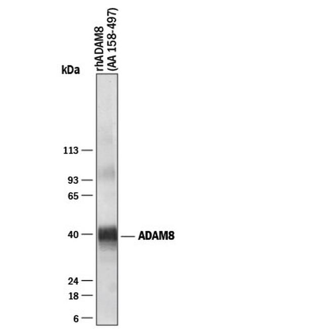 ADAM8 Antibody in Western Blot (WB)