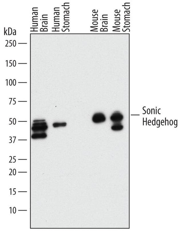 SHH Antibody in Western Blot (WB)