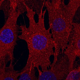 CD105 Antibody in Immunocytochemistry (ICC/IF)