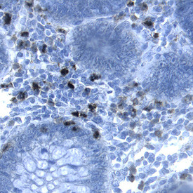 CEACAM1 Antibody in Immunohistochemistry (Paraffin) (IHC (P))