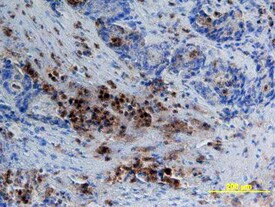 CEACAM1 Antibody in Immunohistochemistry (Paraffin) (IHC (P))