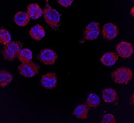 CSF2RA Antibody in Immunocytochemistry (ICC/IF)