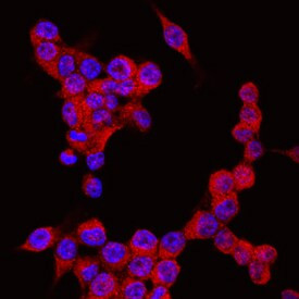 NLRP3 Antibody in Immunocytochemistry (ICC/IF)