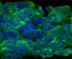 OSMR Antibody in Immunocytochemistry (ICC/IF)