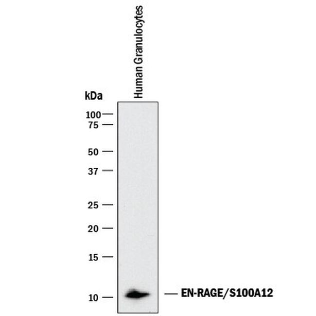 S100A12 Antibody in Western Blot (WB)