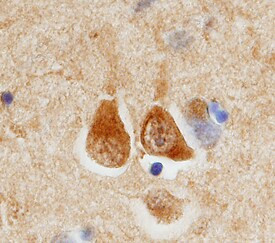 ECE2 Antibody in Immunohistochemistry (Paraffin) (IHC (P))