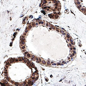 BRCA2 Antibody in Immunohistochemistry (Paraffin) (IHC (P))