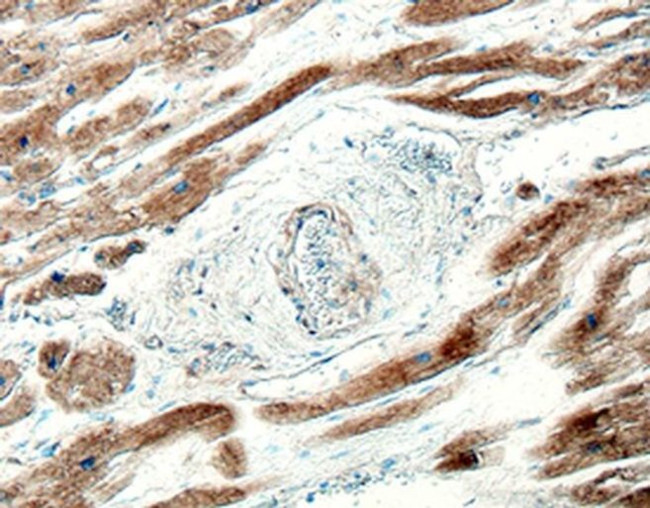 IL17D Antibody in Immunohistochemistry (Paraffin) (IHC (P))