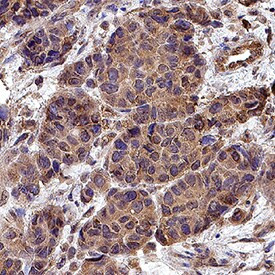 DLL1 Antibody in Immunohistochemistry (Paraffin) (IHC (P))