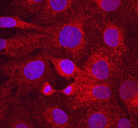 LRP6 Antibody in Immunocytochemistry (ICC/IF)