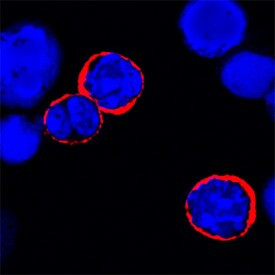IL-6 Receptor Antibody in Immunocytochemistry (ICC/IF)