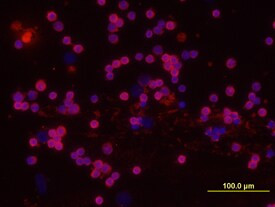 DcTRAILR1 Antibody in Immunocytochemistry (ICC/IF)