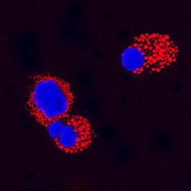 KGF Antibody in Immunocytochemistry (ICC/IF)