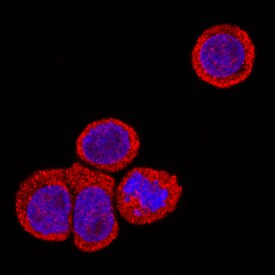 IL-22 Receptor alpha Antibody in Immunocytochemistry (ICC/IF)