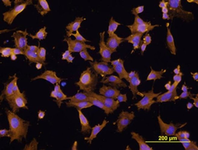 FABP5 Antibody in Immunocytochemistry (ICC/IF)