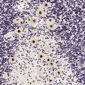 LIM1 Antibody in Immunohistochemistry (Paraffin) (IHC (P))