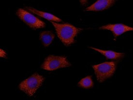 S100A8 Antibody in Immunocytochemistry (ICC/IF)