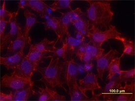 S100P Antibody in Immunocytochemistry (ICC/IF)