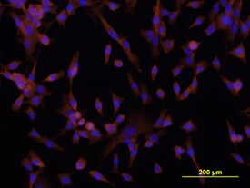 DSCAM Antibody in Immunocytochemistry (ICC/IF)