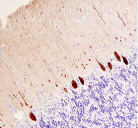 Calbindin D28K Antibody in Immunohistochemistry (Paraffin) (IHC (P))