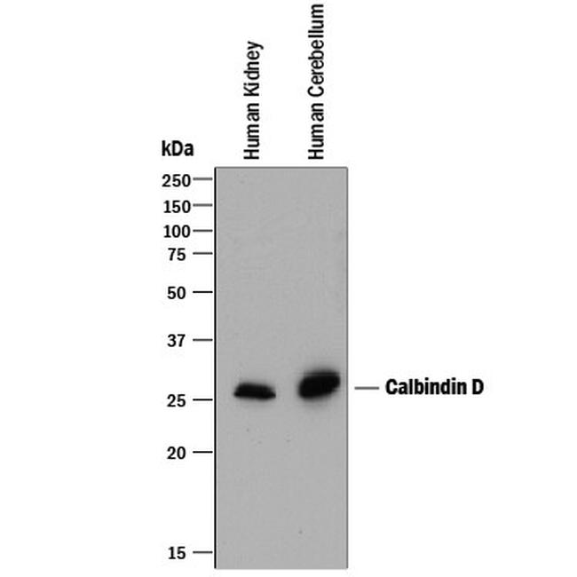 Calbindin D28K Antibody in Western Blot (WB)