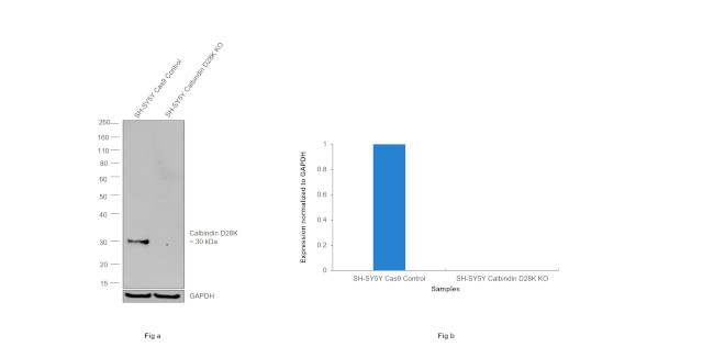 Calbindin D28K Antibody in Western Blot (WB)