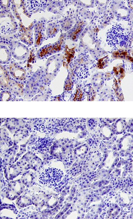 PRSS3 Antibody in Immunohistochemistry (Frozen) (IHC (F))