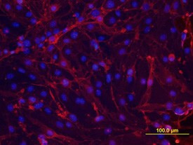 Thrombomodulin Antibody in Immunocytochemistry (ICC/IF)