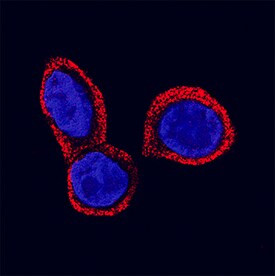 STRA6 Antibody in Immunocytochemistry (ICC/IF)