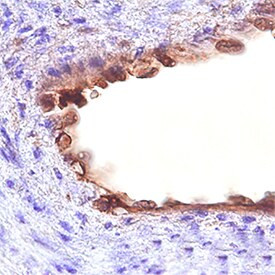 CD109 Antibody in Immunohistochemistry (Paraffin) (IHC (P))