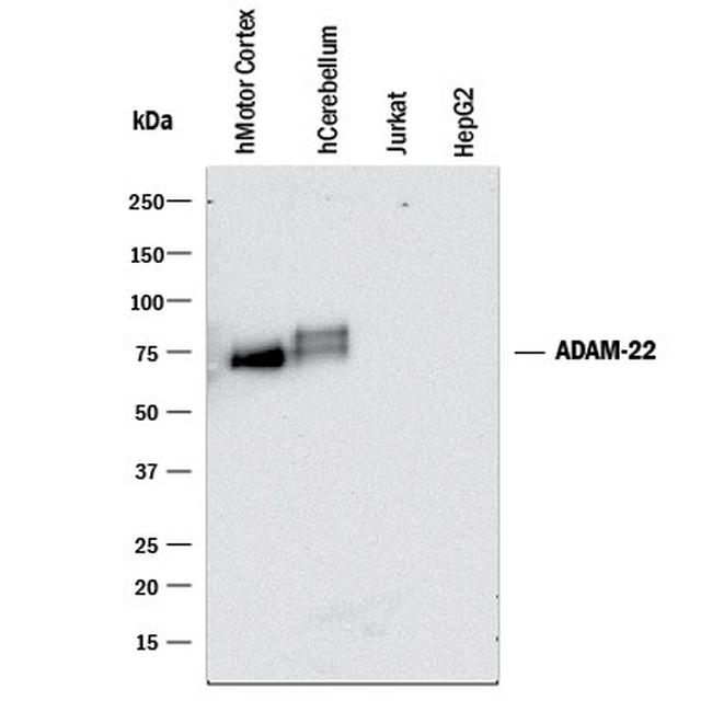 ADAM22 Antibody in Western Blot (WB)