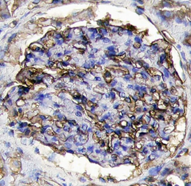 Thrombomodulin Antibody in Immunohistochemistry (Paraffin) (IHC (P))