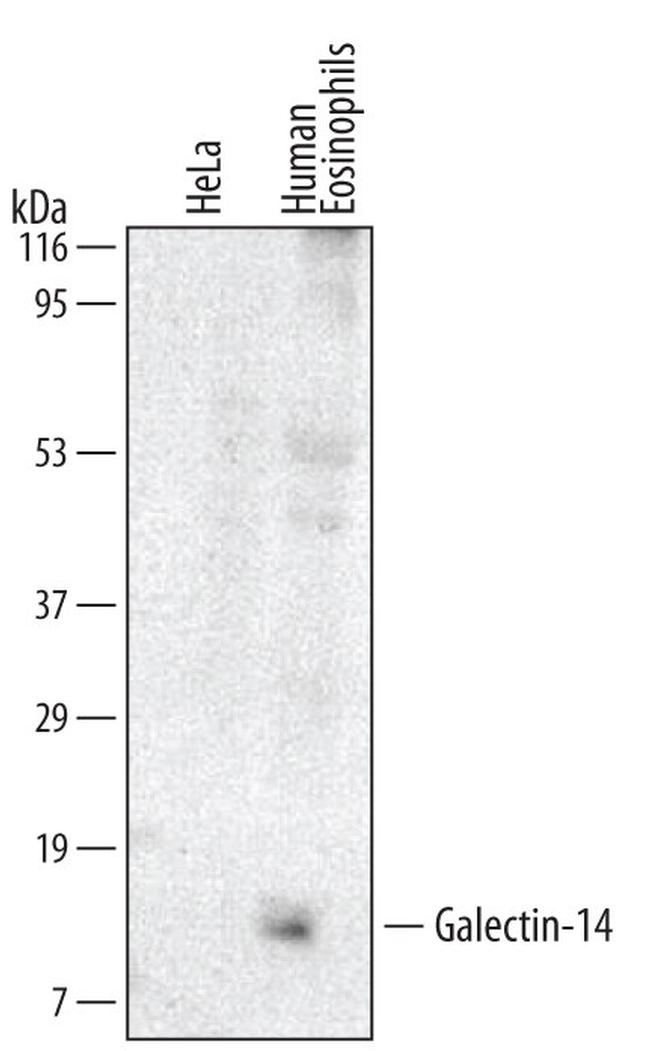 Galectin 14 Antibody in Western Blot (WB)