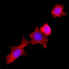 ADAM32 Antibody in Immunohistochemistry (Paraffin) (IHC (P))