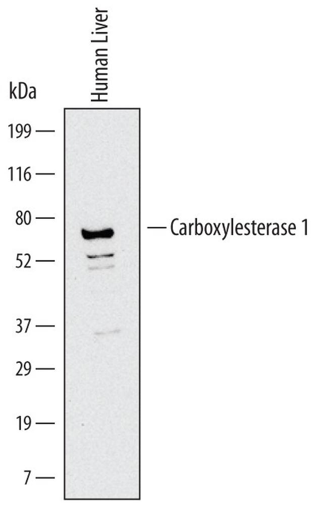 CES1 Antibody in Western Blot (WB)