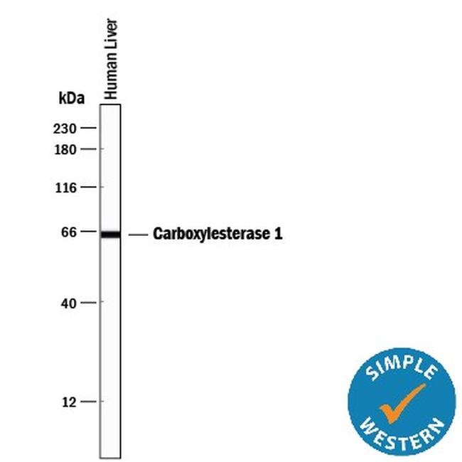 CES1 Antibody in Western Blot (WB)