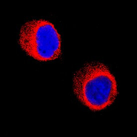 Galectin 10 Antibody in Immunocytochemistry (ICC/IF)