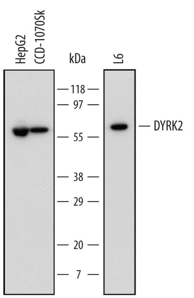 DYRK2 Antibody in Western Blot (WB)