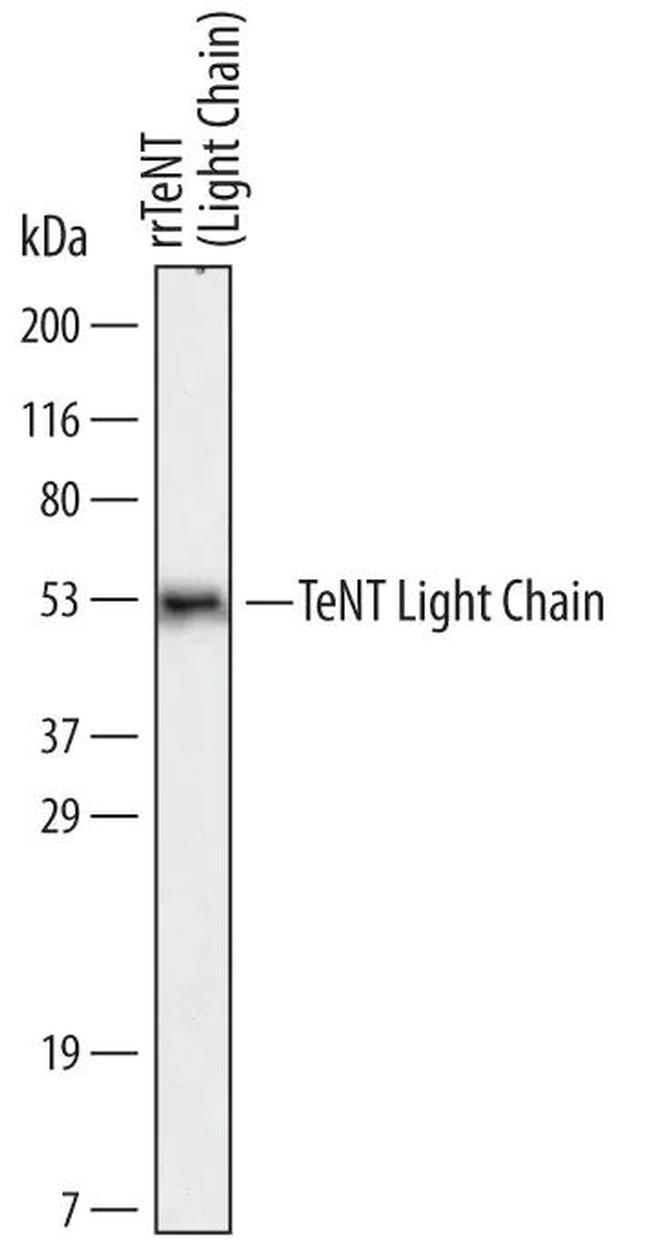 C. tetani TeNT Light Chain Antibody in Western Blot (WB)
