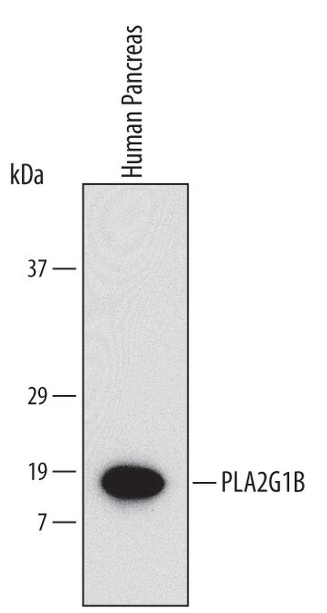 PLA2 Antibody in Western Blot (WB)