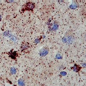 SULT1A1 Antibody in Immunohistochemistry (Paraffin) (IHC (P))