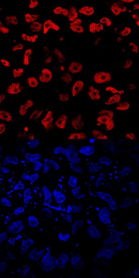 EOMES Antibody in Immunocytochemistry (ICC/IF)