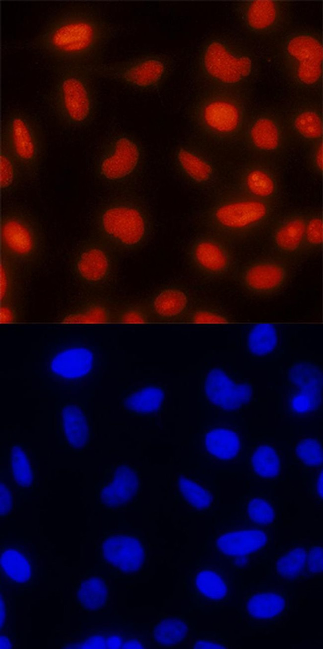 TOP2B Antibody in Immunocytochemistry (ICC/IF)