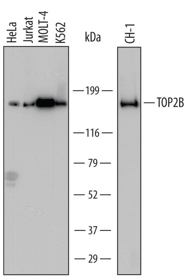 TOP2B Antibody in Western Blot (WB)