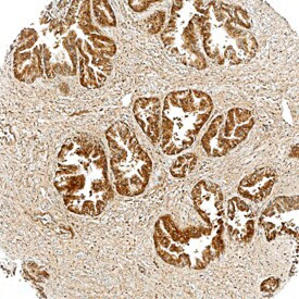 Tensin 4 Antibody in Immunohistochemistry (Paraffin) (IHC (P))