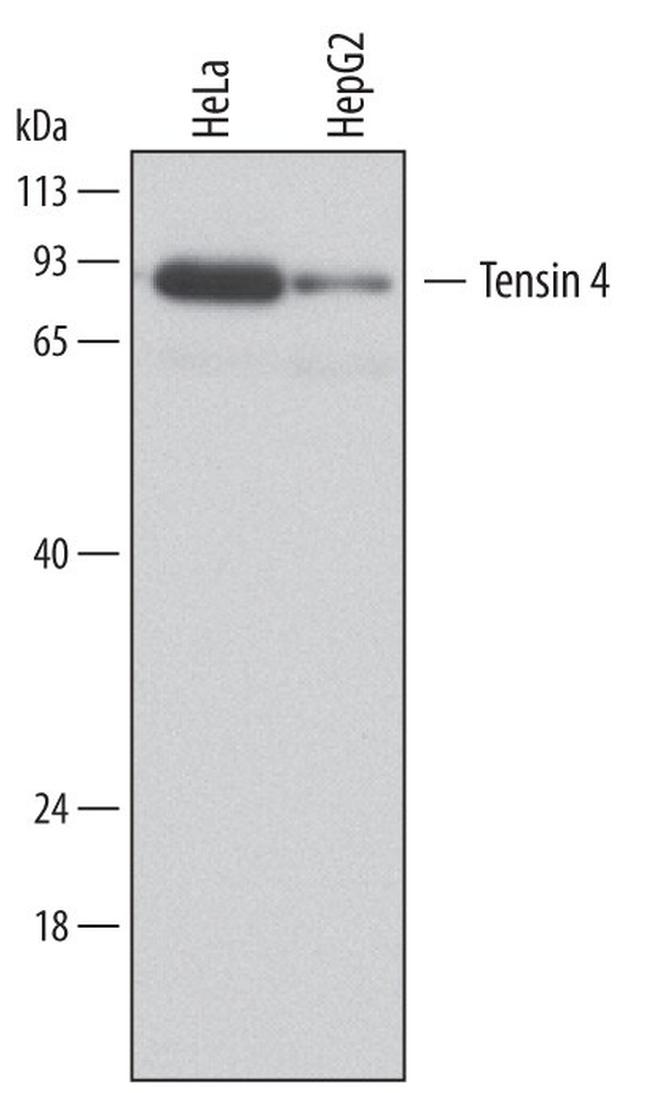 Tensin 4 Antibody in Western Blot (WB)