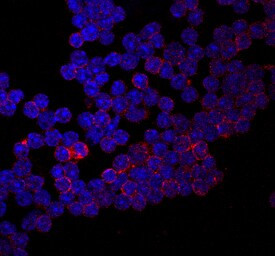 CD155 Antibody in Immunocytochemistry (ICC/IF)