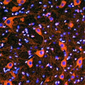 VAPB Antibody in Immunohistochemistry (Frozen) (IHC (F))