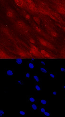 DLX5 Antibody in Immunocytochemistry (ICC/IF)